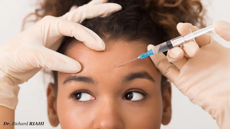 Botox ou acide hyaluronique