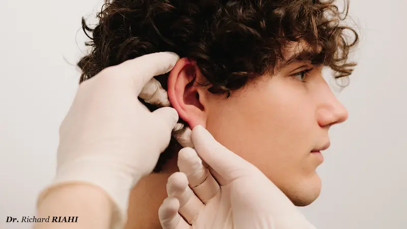Oreilles décollées